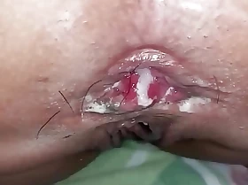 Sexy Juvenile Pinay Anal Sex with Long Ass Creampie Closeup