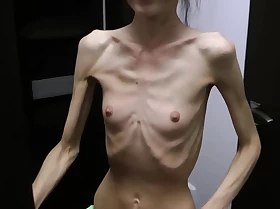 Anorexic Denisa posing and has ribs gripped